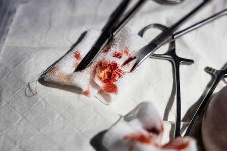 Extracted ingrown toenail with blood on gauze swabs with surgical tools in hospitalの写真素材