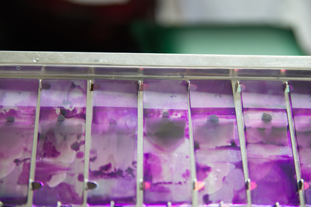 Close-up detail of multiple glass slides of blood samples stained with a purple cellular dye. Healthcare and medicine concept.の写真素材