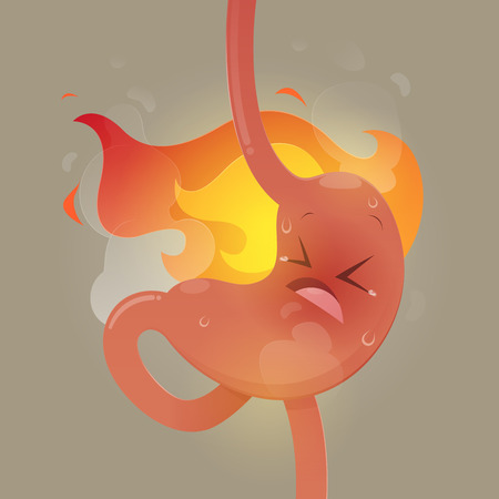 Illustration from acid reflux or heartburn, Cartoon vector, Concept with internal healthのイラスト素材