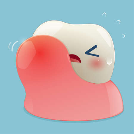 illustrstion of gum disease. Periodontal disease. Periodontitis disease. Vector and Cartoonのイラスト素材
