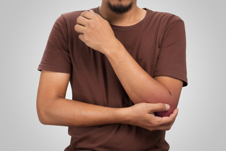 The man's elbow swollen redness because accident.の写真素材