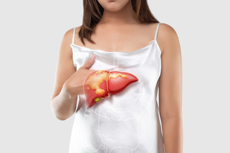 Understand fatty liver disease and its impact on women's health. Learn about symptoms, prevention, and lifestyle changes to combat this growing concern. Prioritize your well-being.の写真素材