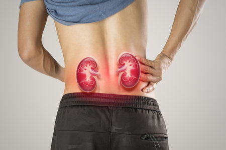 Image shows lower back kidney pain, a common symptom of chronic kidney disease or acute renal...
