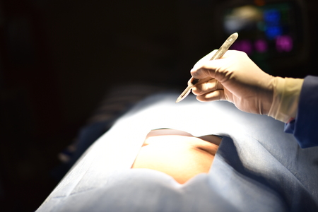 Surgical light in the operating room. Preparation for the beginning of surgical operation with a...