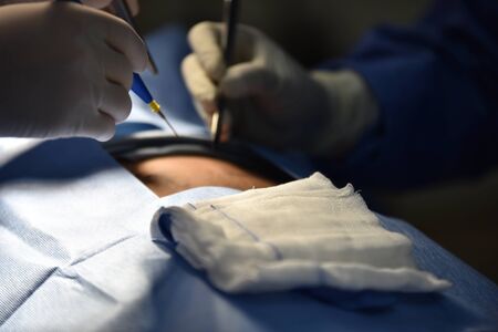 Team surgeon at work in operating room. Surgical light in the operating room. Preparation for the beginning of surgical operation with a cut. The surgeon is performing surgery on the patient.の写真素材