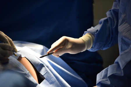 Team surgeon at work in operating room. Surgical light in the operating room. Preparation for the beginning of surgical operation with a cut. The surgeon is performing surgery on the patient.の写真素材