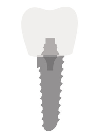 Dental implant structure. Medical educative infographic poster. Teeth implant, realistic vector design of dentistry. Implant screw, healthcare, dentist and orthodontist treatmentのイラスト素材