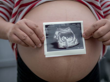 Pregnant woman holding ultrasound scan on her tummyの写真素材