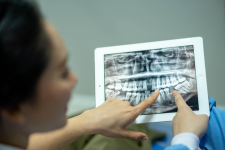 Panoramic Dental X-Ray with hand pointing at tablet screen and film