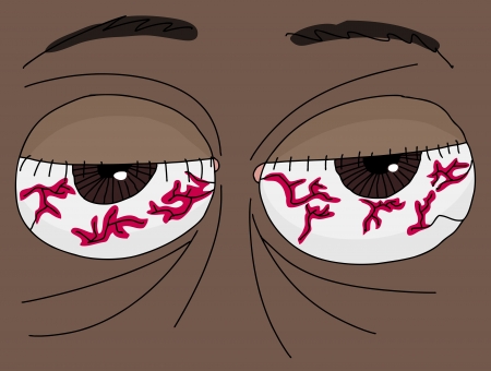 Close up of a pair of human bloodshot eyesのイラスト素材