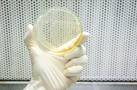 Hand in glove is holding a petri dish of cross streak of Saccharomyces cerevisiae (baker yeast)...