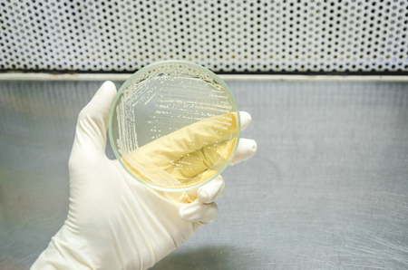 Hand in glove is holding a petri dish of cross streak of Saccharomyces cerevisiae (baker yeast) growing on yeast extract peptone dextrose agar plate. microbiology laboratory test.の写真素材