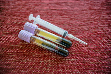 Syringe , needle and blood tube,Medical laboratoryの写真素材