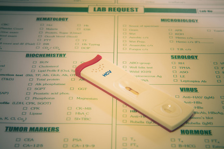 Lab request for Hepatitis C virus test,Result HCV negative cassette test,Vintage toneの写真素材