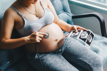 Pregnant women use stethoscope examining listen baby tummy, Women activity free timeの写真素材