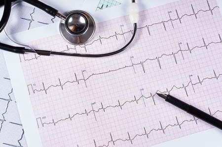 Electrocardiogram EKG graph paper, stethoscope and pen, Close-up.の写真素材