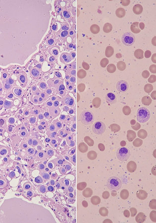 Blood smear with light micrograph of human blood cells under microscope.