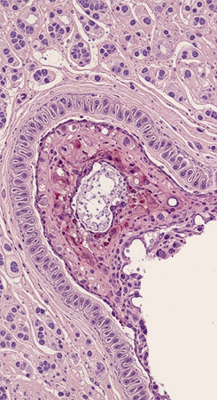 Histopathology of human muscle tissue. Histological sample of human muscle tissue.
