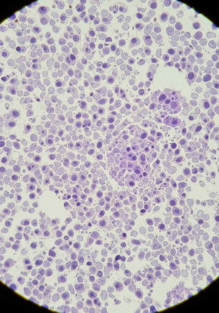 Blood smear with light micrograph of human stomach.
