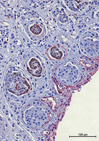 Microscopic view of human pancreas, photomicrograph