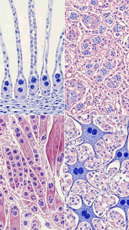 Histopathology of human hair follicle.