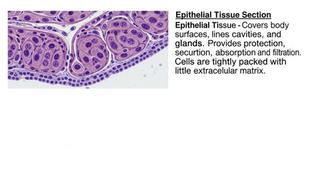 Histopathology of liver cancer, light micrograph, photo under microscopeの写真素材
