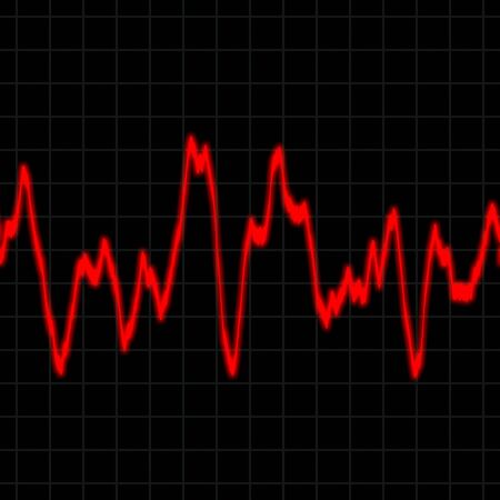 Illustration of the electrical activity of the human heart.