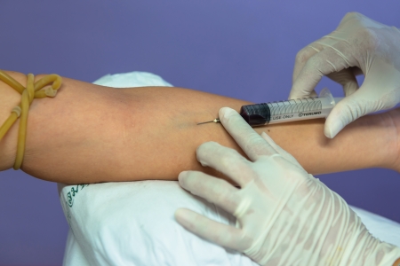 blood sample extracted from a vein in the arm using a needleの写真素材