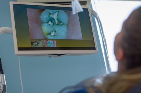 Great concept of dental procedure, a young blond Brazilian woman in the dental chair
