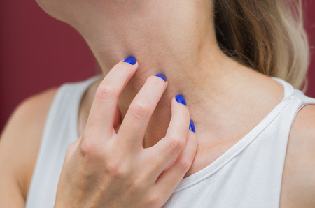 Great concept of allergy and skin diseases, young woman scratching herself.