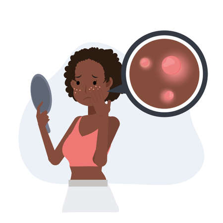 Acne concept.pimples. skin problems. African american woman is worried about her face getting acne. Flat vector cartoon character illustration.のイラスト素材