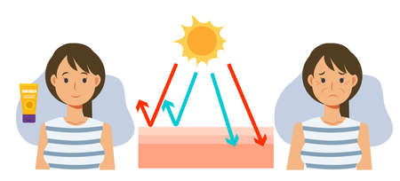 Skin care concept,sun protection.skin damage UV,sunblock ,sunscreen.skin layers.Uva uvb Vector...
