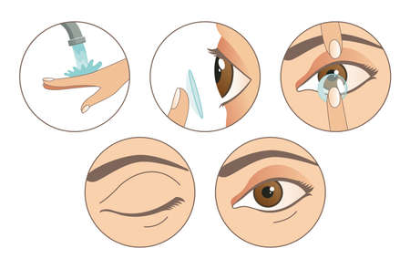 Contact lenses. Instruction how to use contact lenses. 6 steps. Wash your hands, take a lens, check the position of the lens. Carefully insert the lensのイラスト素材