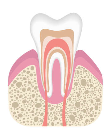 Healthy tooth is not infected with caries. Stage before of caries development. Tooth structure in flat style. Tooth with enamel. Realistic vector illustrationのイラスト素材
