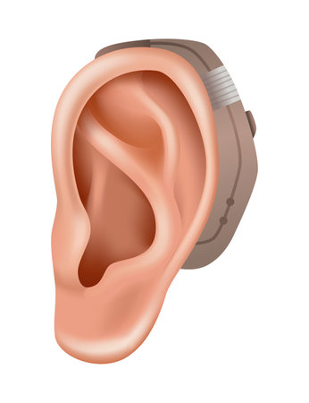 Hearing aid. Sound amplifier for patients with hearing loss. Medicine and health. Realistic object behind the ear. Treatment and prosthetics in otolaryngologyのイラスト素材