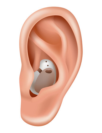 Hearing aid. Sound amplifier for patients with hearing loss. Medicine and health. Realistic object behind the ear. Treatment and prosthetics in otolaryngologyのイラスト素材