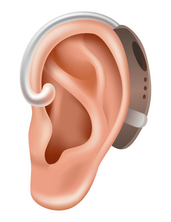 Hearing aid. Sound amplifier for patients with hearing loss. Medicine and health. Realistic object behind the ear. Treatment and prosthetics in otolaryngologyのイラスト素材
