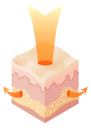 Protection uv ray skin. Illustration about Skin care concept. Sun protection body adipose layers epidermis, vector infographicのイラスト素材