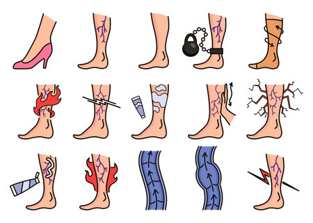 Varicose treatment icons set. Violation of circulatory system. Vascular disease diagnostic. Venous insufficiency medical disease. Vector illustrationのイラスト素材