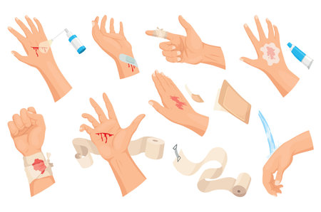 Hands injured skin and procedures of bandaging and wound cleaning. First aid for wound. Medicine cure or treatment. First emergency help for human hand traumaのイラスト素材