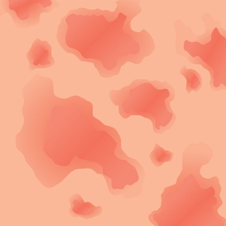 Type of psoriasis vector. Part of patients skin with dermatitis, inflammation, red rash and other skin problems. Cartoon illustration for disease conceptのイラスト素材