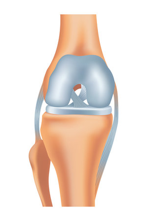 Knee arthrosis. Healthy knee structure. Bone exposure, healthy knee structure comparison. Medical poster with foot bones. Isolated vector illustrationのイラスト素材