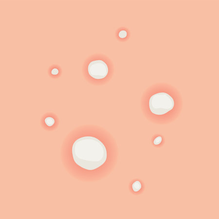 Understanding Type of Acne A Comprehensive Visual Guide for Everyoneのイラスト素材