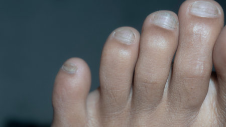 Toes of a person. feet of a human.の写真素材