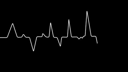 Abstract heartbeat line on a black background.の写真素材