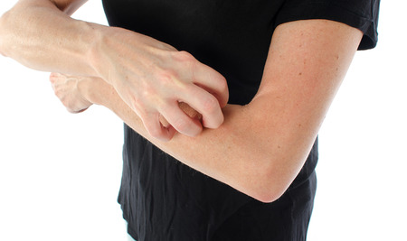 Woman scratching her arm, isolated on whiteの写真素材