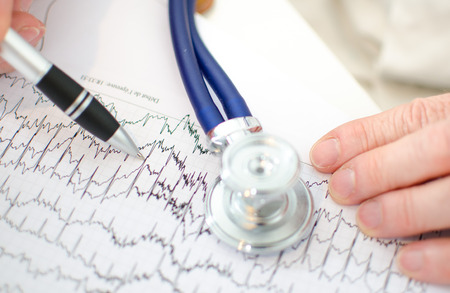 Doctor analyzing electrocardiogram, closeup
