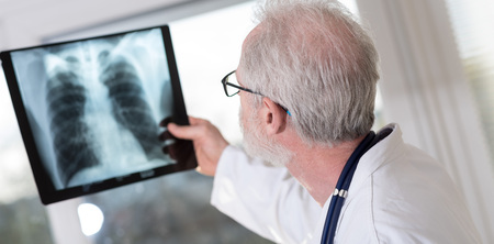 Doctor looking at x-ray report