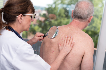 Dermatologist examining the skin on the back of a patientの写真素材
