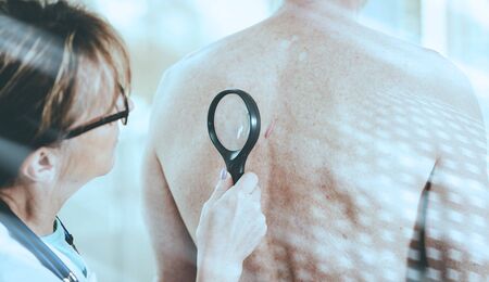 Dermatologist examining the skin on the back of a patient; light effectの写真素材